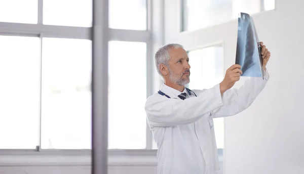 What Have Here Doctor Inspecting Patients Ray — Stock Photo, Image