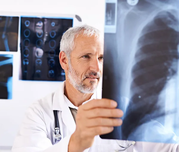 他是一位放射专家 在医院里看X光照片的成熟的男医生 — 图库照片