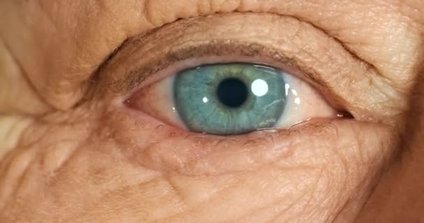 Me18 Oční Vidění Senioři Oči Staršího Pacienta Test Zelený Zákal — Stock video