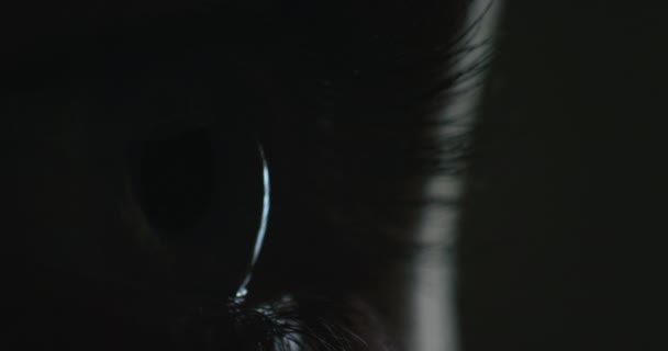 Здоровье Зрение Крупным Планом Глаза Женщины Темноте Слепота Дальтонизм Лазерная — стоковое видео