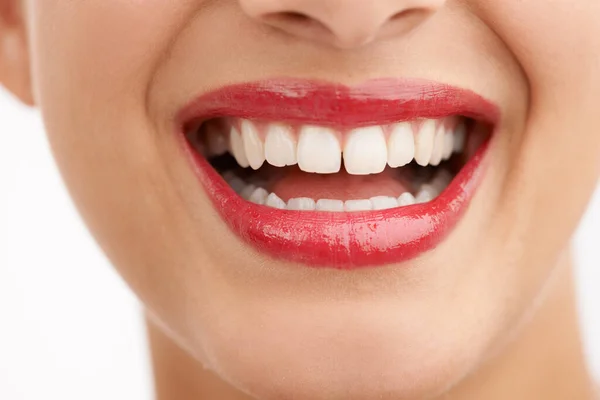 Shiny White Smile Cropped Closeup Shot Beautiful Young Womans Mouth — Stock Photo, Image