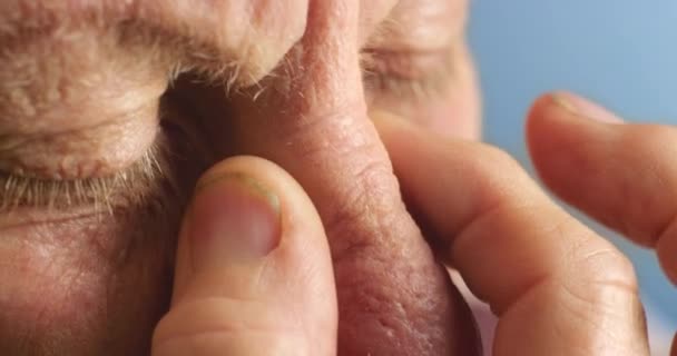 Sinus Zdravotní Problém Starší Muž Dotýkající Obličeje Pro Snížení Tlaku — Stock video
