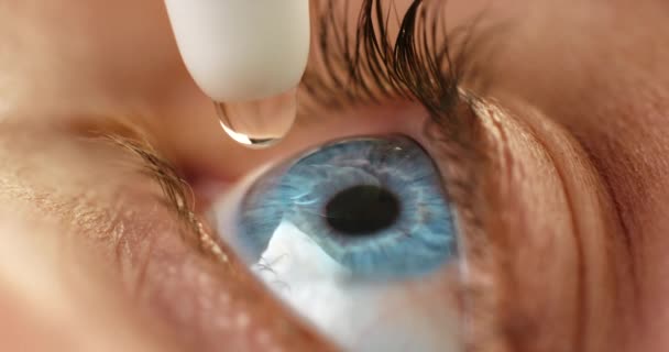 Augentropfen Medizin Und Augengesundheit Zur Unterstützung Des Sehvermögens Sicherheit Der — Stockvideo