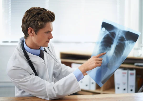 Шукаю Причину Молодого Лікаря Який Вивчає Рентген Грудної Клітини — стокове фото