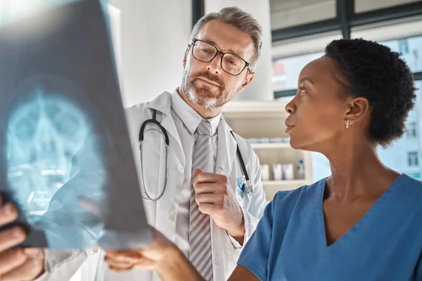 Brain, x ray and neurology doctors in a meeting working on a skull injury in emergency room in a hospital. Diversity, cancer and healthcare medical neurologist checking mri or xray scan with teamwork.