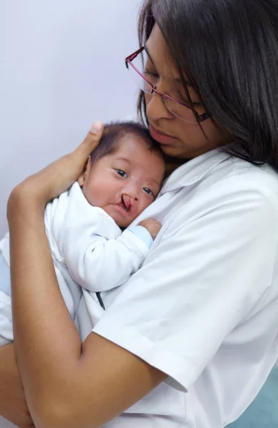 Trost Spenden Ein Kleinkind Mit Gaumenspalte Wird Von Seiner Mutter — Stockfoto