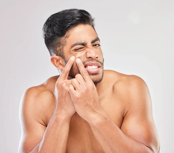 Cuide Bem Sua Pele Jovem Estourando Uma Espinha Contra Fundo — Fotografia de Stock