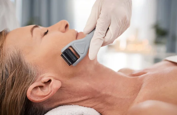 Be extra gentle when using a roller. Closeup shot of a mature woman enjoying a micro-needling treatment at a spa