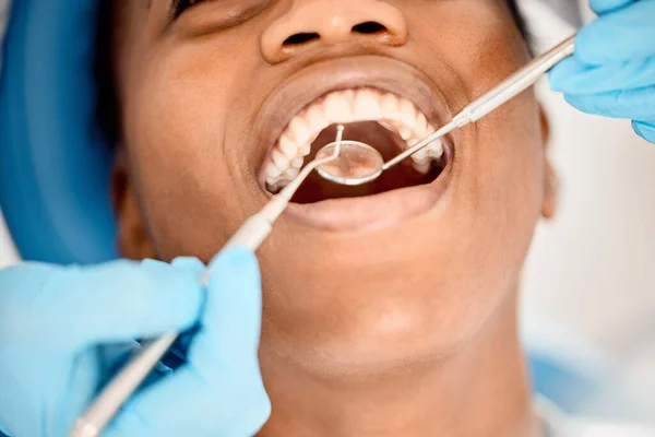 Open Wide Please Young Female Patient Having Her Teeth Examined — Stock Photo, Image