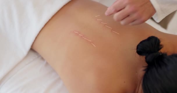 Akupunktur Lyxigt Spa Och Massage Kroppsterapi Wellness Och Vård Salongen — Stockvideo