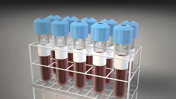 Blood vials rack Stock Photos, Royalty Free Blood vials rack Images ...