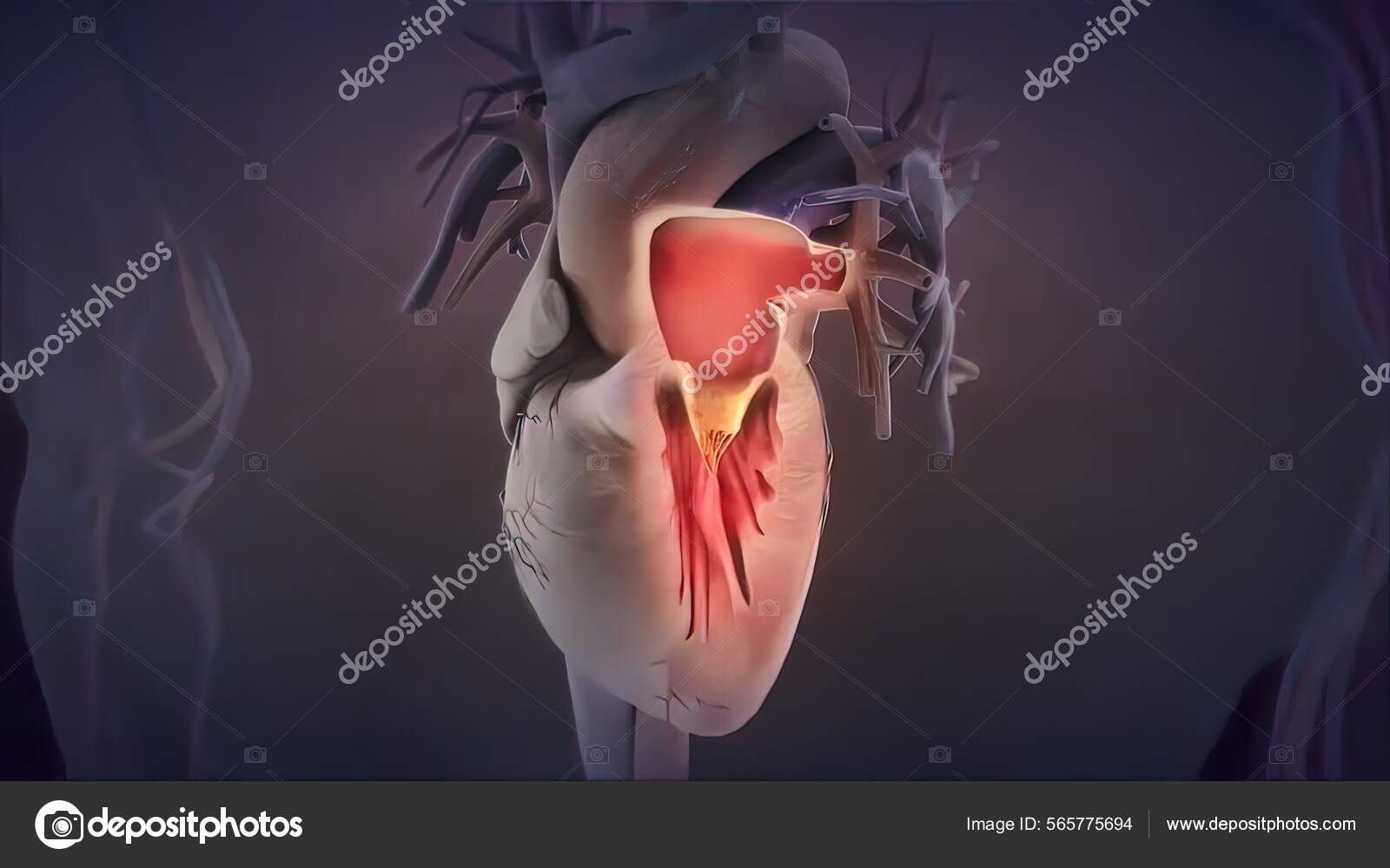 Heart Valve Inflammation Illustration Stock Photo by ©soundpic 565775694