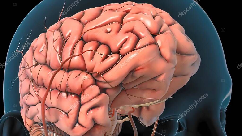 Atherosclerosis, . Atherosclerosis is the narrowing of arteries due to