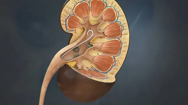 Nephrolithiasis Stock Photos, Royalty Free Nephrolithiasis Images | Depositphotos Nephrolithiasis Stock Photos, Royalty Free Nephrolithiasis Images | Depositphotos