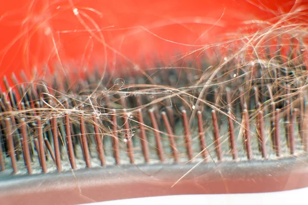 Conceito Perda Cabelo Mulheres Pente Com Cabelo Close — Fotografia de Stock