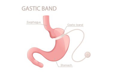 İnsan midesi karikatür tasarımı beyaz arka planda insan anatomisi organı çizimi