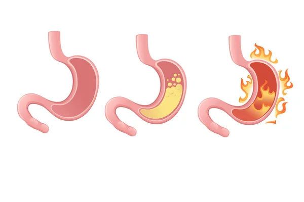 人間の胃の漫画のデザイン白い背景に人間の解剖学的器官のベクトルイラスト — ストックベクタ