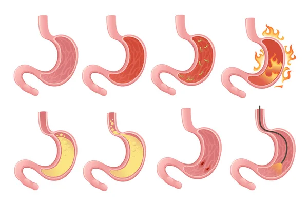 Set Disegno Del Fumetto Stomaco Umano Anatomia Umana Organo Vettoriale — Vettoriale Stock