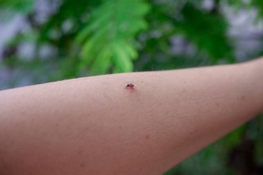 Aedes sivrisinekleri, midesi kızarana kadar kanla beslenir..