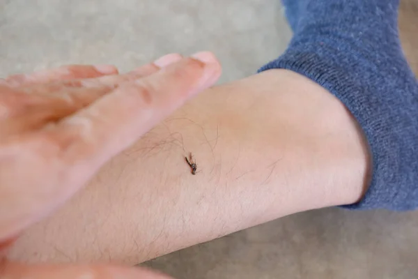 Aedes Mosquito Que Fue Golpeado Hasta Muerte Pierna — Foto de Stock