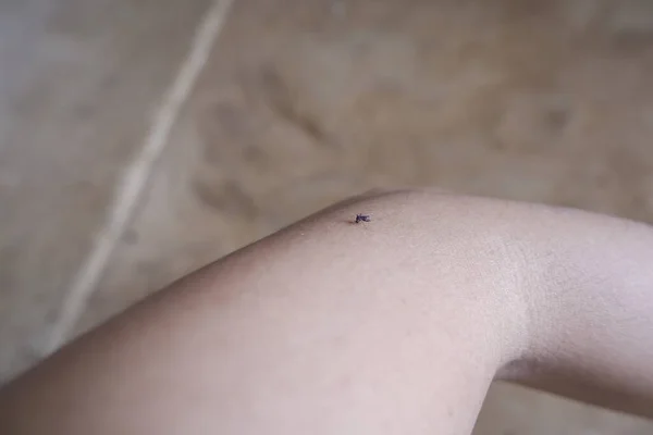 Aedes Mosquito Sucking Blood Arm — Foto de Stock