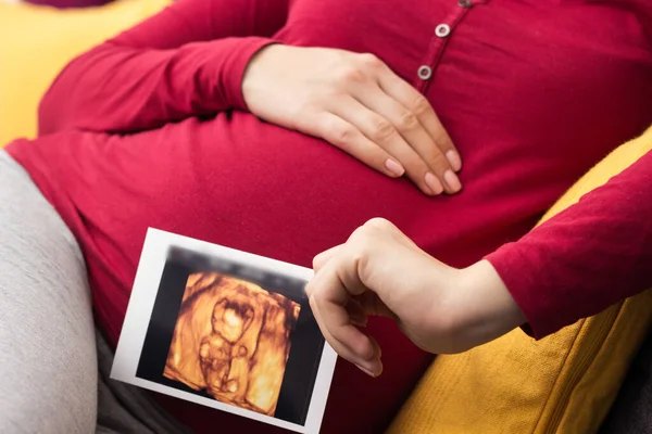 Pregnant Woman Keeping Hand Belly Holding Ultrasound Image Home Interiors — стоковое фото