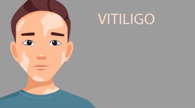 Vitiligo 'lu bir adamın portresi. Kendini sevmek. Dünya Vitiligo Günü. Deri hastalıkları. Metin için alanı olan çizgi film tarzında vektör illüstrasyonu