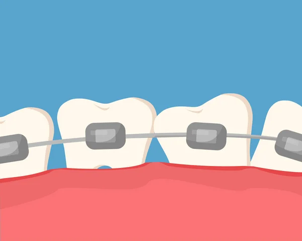 Redressez Les Dents Tordues Avec Des Bretelles Traitement Orthodontique Caricature — Image vectorielle