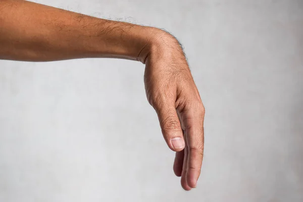 Lesión Del Nervio Radial Caída Muñeca Del Hombre Asiático —  Fotos de Stock