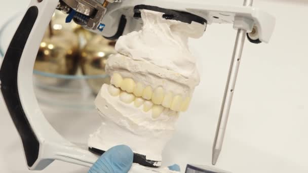 Крупним планом стоматолога або спеціаліста стоматологічного імплантату, який тримає реалістичне компонування щелепи людини з імплантатами — стокове відео