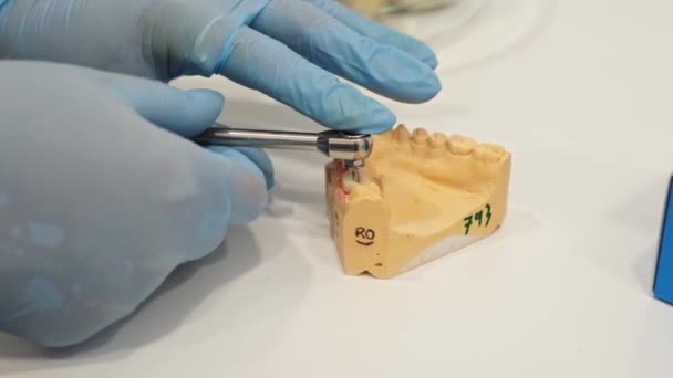 Zubní protéza v gumových rukavicích zobrazující proces instalace koruny na rozložení lidské čelisti — Stock video