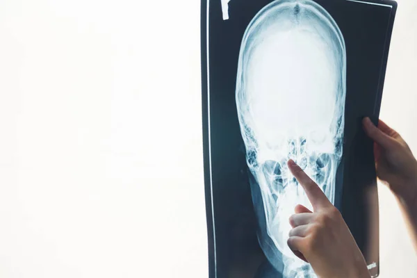 Лікар вказує на рентгенівський знімок головної студії медичної концепції — стокове фото