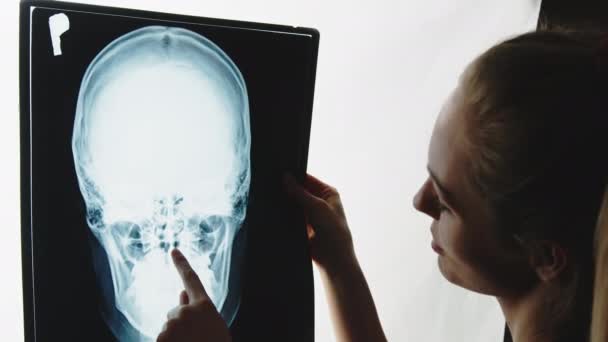Female orthopedist explaining and analyzing skull xray very serious, close up slowmotion — Wideo stockowe