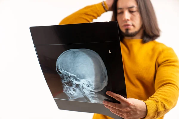 Caucasian bearded man holding his skull x-ray while wearing yellow sweatshirt. Isolated over white background. — стокове фото
