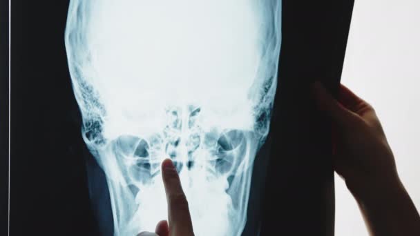 Badanie rentgenowskie pojęcia medycznego czaszki w pomieszczeniach — Wideo stockowe