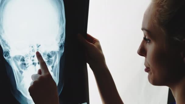 Female doctor examining x-ray of head closeup indoors medical concept — Wideo stockowe