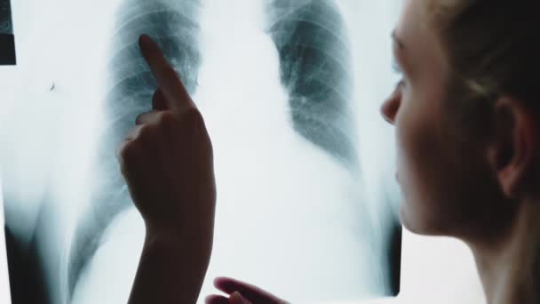 의사가 갈비뼈를 손가락으로 가리키는 엑스레이 사진을 있습니다 고품질 — 비디오