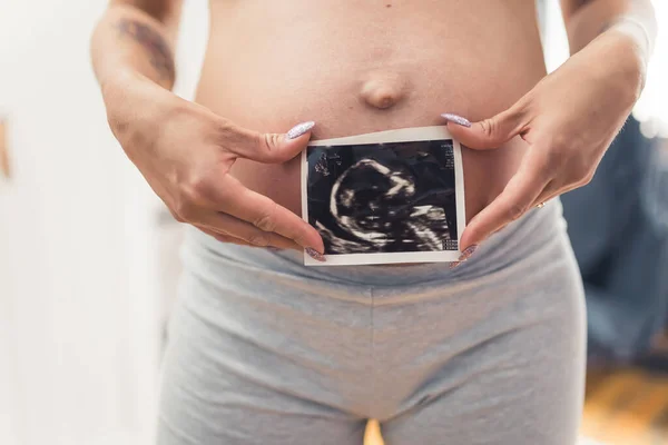 Hamile Bir Kadın Karnının Önünde Ultrason Taraması Yapıyor Yüksek Kalite — Stok fotoğraf