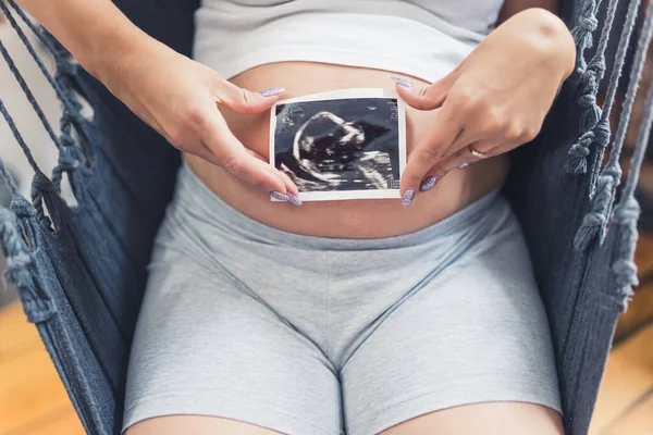 Printed Ultrasound Picture Head Baby Pregnancy Proud Caucasian Pregnant Mother —  Fotos de Stock