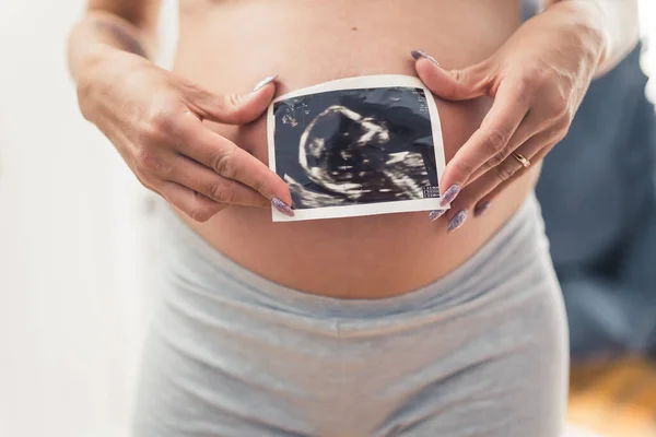 Usg Picture Baby Pregnancy Held Two Hands Long Sparkly Nails — 스톡 사진