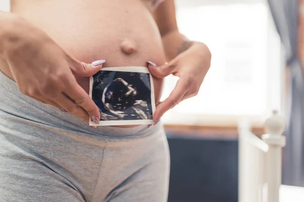 Pregnant Belly Caucasian Person Gray Biker Shorts Scan Her Unborn —  Fotos de Stock