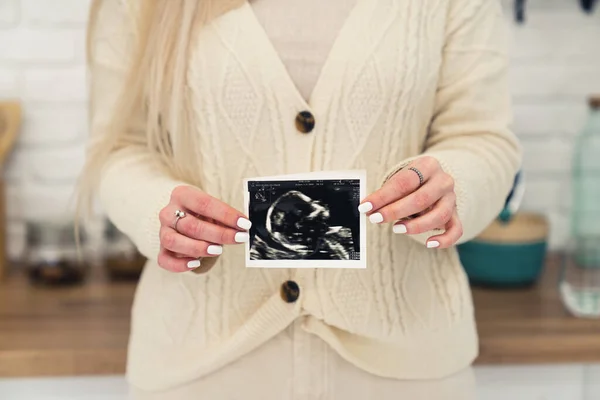 Örgü Kazak Giyen Beyaz Bir Kadın Kameraya Bebeğin Ultrason Fotoğrafını — Stok fotoğraf