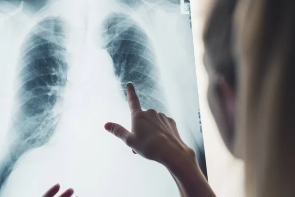 Медсестра Вказує Палець Сканування Легенів Високоякісна Фотографія — стокове фото