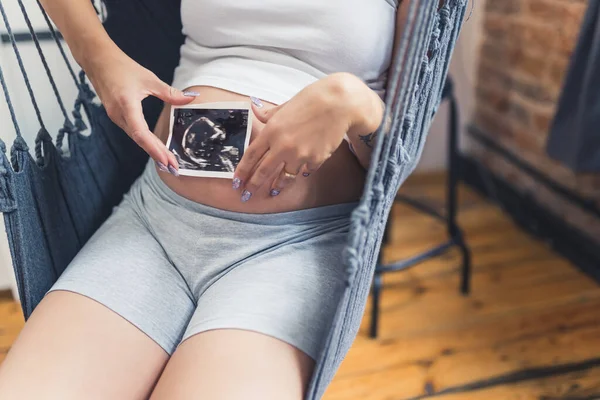 Kavkazská Těhotná Žena Ultrazvukovým Skenem Dětském Bouli Kvalitní Fotografie — Stock fotografie
