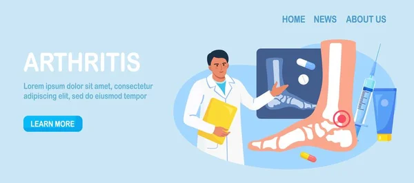 Artritis Tobillo Doctor Examinando Radiografías Articulaciones Osteoartritis Artritis Reumatoide Enfermedad — Archivo Imágenes Vectoriales