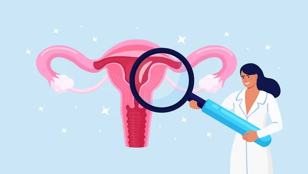 Lékaři Gynekolog Dělat Děložní Vyšetření Lupou Gynekologie Ženský Zdravý Reprodukční — Stockový vektor