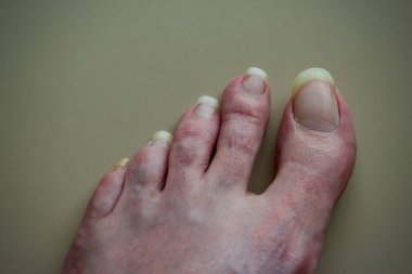 Uzun ayak tırnaklı beyaz adam ayağı.