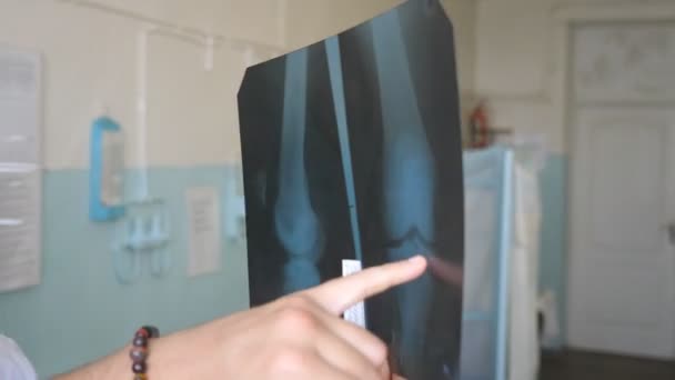 Doi medici caucazieni văd imaginea lui Mri şi discută despre asta. Lucrătorii medicali din spital examinează amprentele cu raze X. Medicii de sex masculin se consultă unul cu celălalt în timp ce se uită la imaginea cu raze X. Close up — Videoclip de stoc