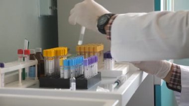 Laboratuvarda deney tüpleriyle çalışan bilim adamlarının ya da doktorların elleri. Tıbbi eldivenli doktor COVID-19 'a kan örneği alıp imzaladı. Sağlık ve koronavirüs salgını kavramı