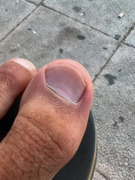 Closeup Male Toe — Foto de Stock